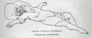 Grande attaque hystérique. Attitude de crucifiement. in J. Morin, L'hystérie et les superstitions religieuses. Paris, L'émancipatrice (Imprimerie communiste), 1902.