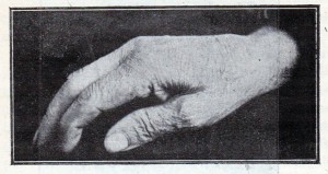 La main du même mendiant thésaurisateur (fig. 2).