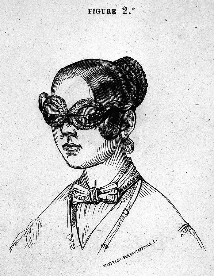 Donne Alfred Marie François - Somnambulisme et magnétisme animal. Noyon 1838. Figure 2; Jeune fille somnambule avec un bandeau sur les yeux.