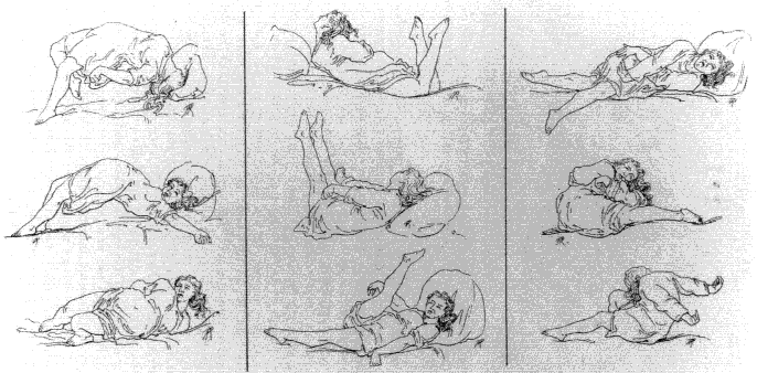 Positions dans une attaque de grande hystérie. - Études  cliniques sur le grande hystérie ou hystéro-épilepsie  (Paris- Delahaye & Lecrosnier, 1881), planche 5. 
